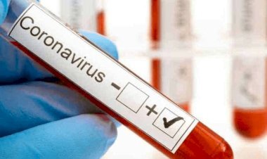 धनबाद: एमपी पीएन सिंह के बॉडीगार्ड, प्रगति नर्सिंग होम के डॉक्टर समेत छह नये कोरोना पेसेंट मिले ,संक्रमितों की संख्या 326 पहुंची