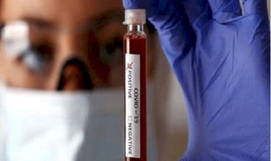 धनबाद: PMCH में एडमिट 64 साल का बुजुर्ग पहले नेगेटिव फिर पॉजिटिव निकला