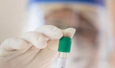 नई दिल्ली: इंडिया में कोरोना संक्रमितों की संख्या 35 लाख 50 हजार पार, 64 हजार मौतें