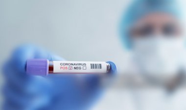 झारखंड में 13 सितंबर को मिले मिले 1014 कोरोना पॉजिटिव, 11 मरीजों की मौत, स्टेट में संक्रमितों की संख्या 61474 हुई