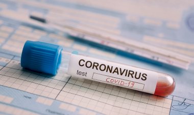 धनबाद: 19 सितंबर को मिले 74 कोरोना पॉजिटिव, जिले में  संक्रमितों की संख्या 4421 हुई