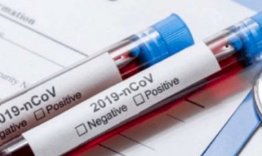 झारखंड: 27 सिंतबर को 964 नये कोरोना पेसेंट मिले, स्टेट में संक्रमितों की संख्या 79,899 हुई