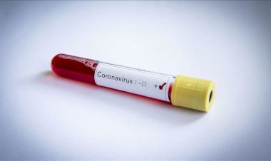 धनबाद में चार अक्टूबर को 55 कोरोना पॉजिटिव मिले, जिले में संक्रमितों की संख्या 5299 हुई