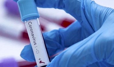 झारखंड में चार सितंबर को 933 कोरोना पॉजिटिव मिले, नौ की मौत, स्टेट में संक्रमितों की संख्या 87210 पहुंची