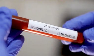 नई दिल्ली: देश में 75 लाख कोरोना पेसेंट, रिकवरी रेट 88 पर्सेंट के पार