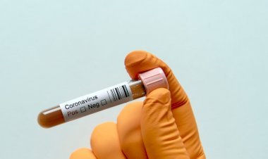 धनबाद में 25 अक्टूबर को 39 कोरोना पॉजिटिव मिले, जिले में संक्रमितों की संख्या 6127 पहुंची