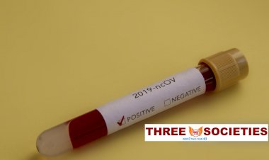 धनबाद में 29 अक्टूबर को 50 कोरोना पॉजिटिव मिले, जिले में संक्रमितों की संख्या 6265 पहुंची