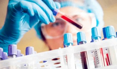 धनबाद में 14 नवंबर को 15 कोरोना पॉजिटिव मिले, जिलें संक्रमितों की संख्या 6780 पहुंची