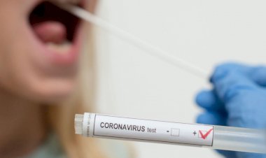 धनबाद में 25 नवंबर को 14 कोरोना पॉजिटिव मिले, जिले में संक्रमितों की संख्या 6947 पहुंची