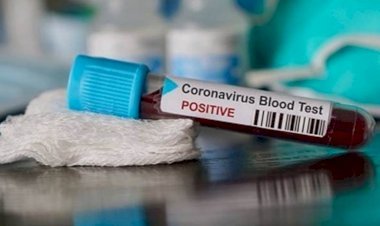 धनबाद में एक दिसंबर को सात कोरोना पॉजिटिव मिले, जिले में संक्रमितों की संख्या 7024 हुई