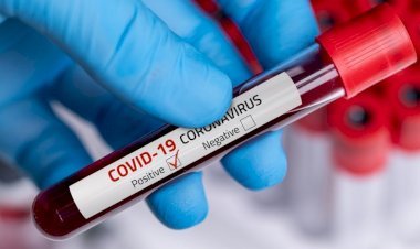 धनबाद में  नौ दिसंबर को 16 नये कोरोना पॉजिटिव मिले,जिले में संक्रमितों की संख्या 7165 पहुंची