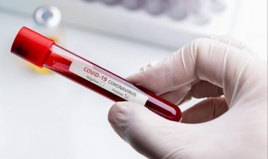 धनबाद में तीन जनवरी को नौ कोरोना पॉजिटिव मिले, जिले में संक्रमितों की संख्या 7474 हुई