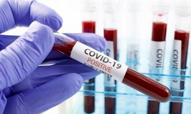 धनबाद:35 वर्ष से अधिक उम्र के कोरोना पॉजिटिव को नहीं मिलेगी होम आइसोलेशन की सुविधा 