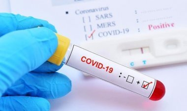 धनबाद में 10 जनवरी को सात कोरोना पॉजिटिव मिले, जिले में संक्रमितों की संख्या 7603 पहुंची