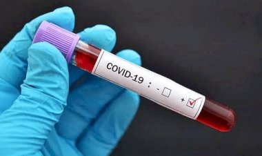 धनबाद में 14 जनवरी को नौ कोरोना पॉजिटिव मिले, जिले में संक्रमितों की संख्या 7658 हुई