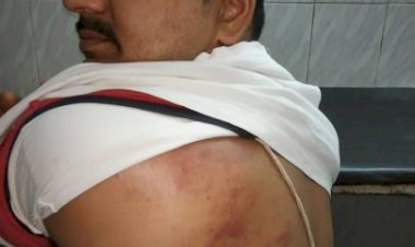 धनबाद: सुदामडीह में रघुकुल व ददई समर्थक भिड़े, पुरानी रंजिश व बीसीसीएल आवास कब्जा करने को लेकर विवाद, पुलिस में कंपलेन