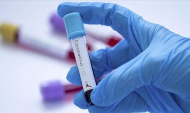 धनबाद में 12 मई को 160 कोरोना संक्रमित मिले, 217 स्वस्थ हुए, नौ की मौत, 19 कंटेनमेंट जोन का निर्माण, लगाया गया कर्फ्यू