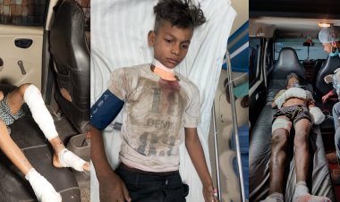 Dhanbad: जोगता में झाड़ी में छिपा कर रखा गया बम विस्फोट, चार बच्चे झुलसे