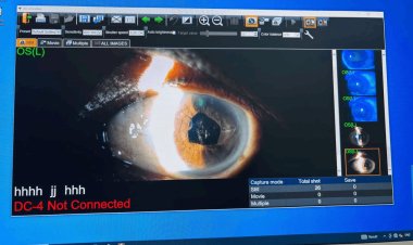 धनबाद: BCCL सेंट्रल हॉस्पिटल के डॉक्टरों ने कर दिखाया कमाल – तीन साल बाद मीना देवी को फिर मिली 6/6 नजर