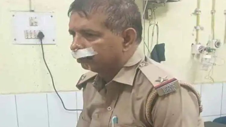 धनबाद में चोर पकड़ने गई पुलिस टीम पर हमला, भूली ओपी के SI हरिप्रकाश मिश्रा घायल